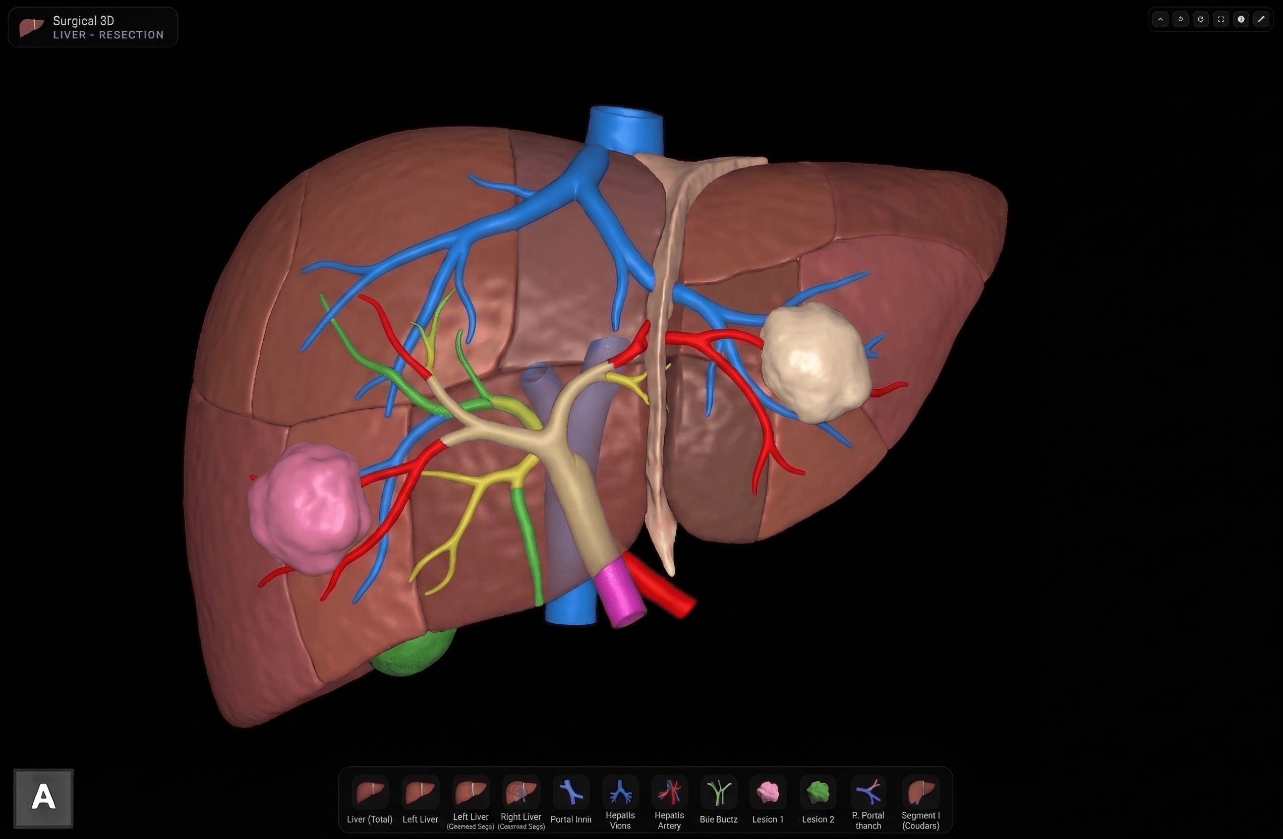 Liver 3D reconstruction