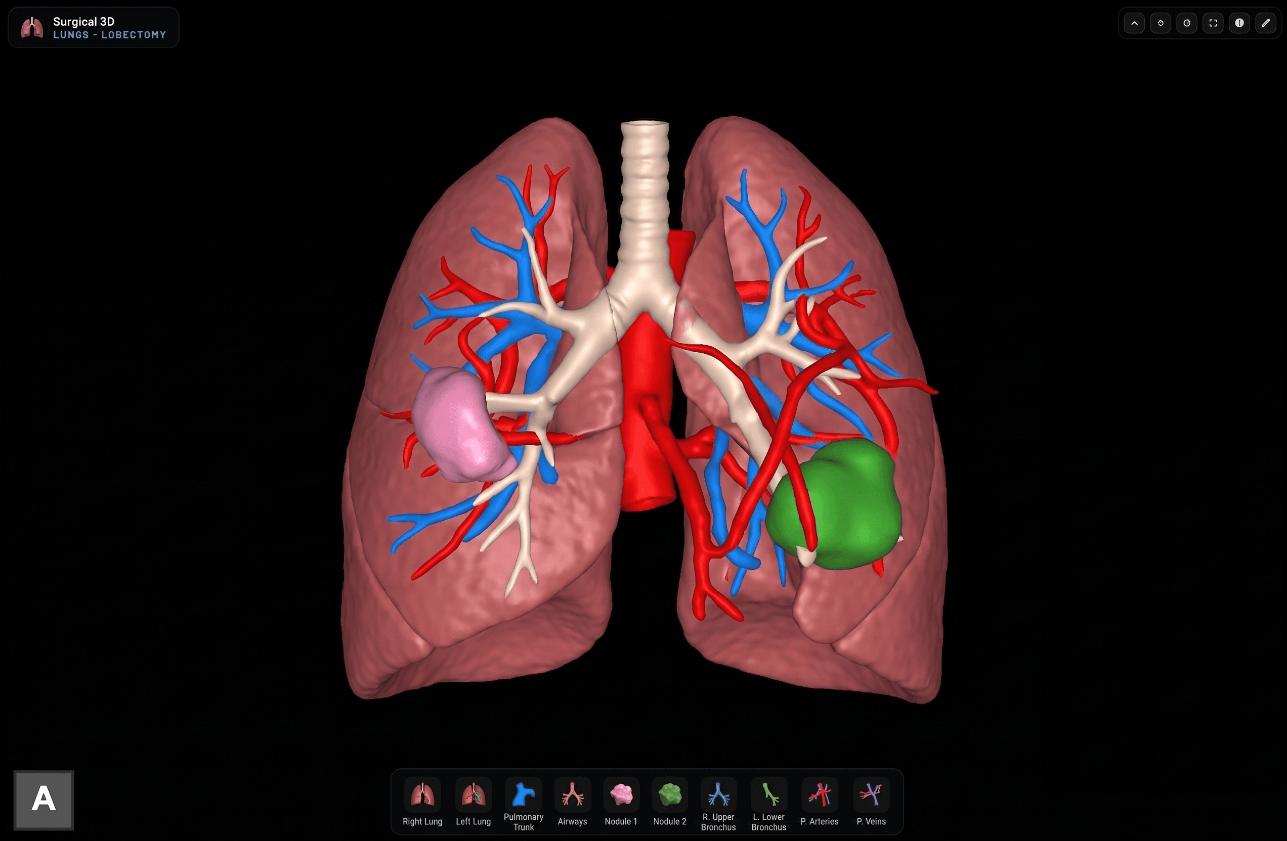 Lung 3D reconstruction