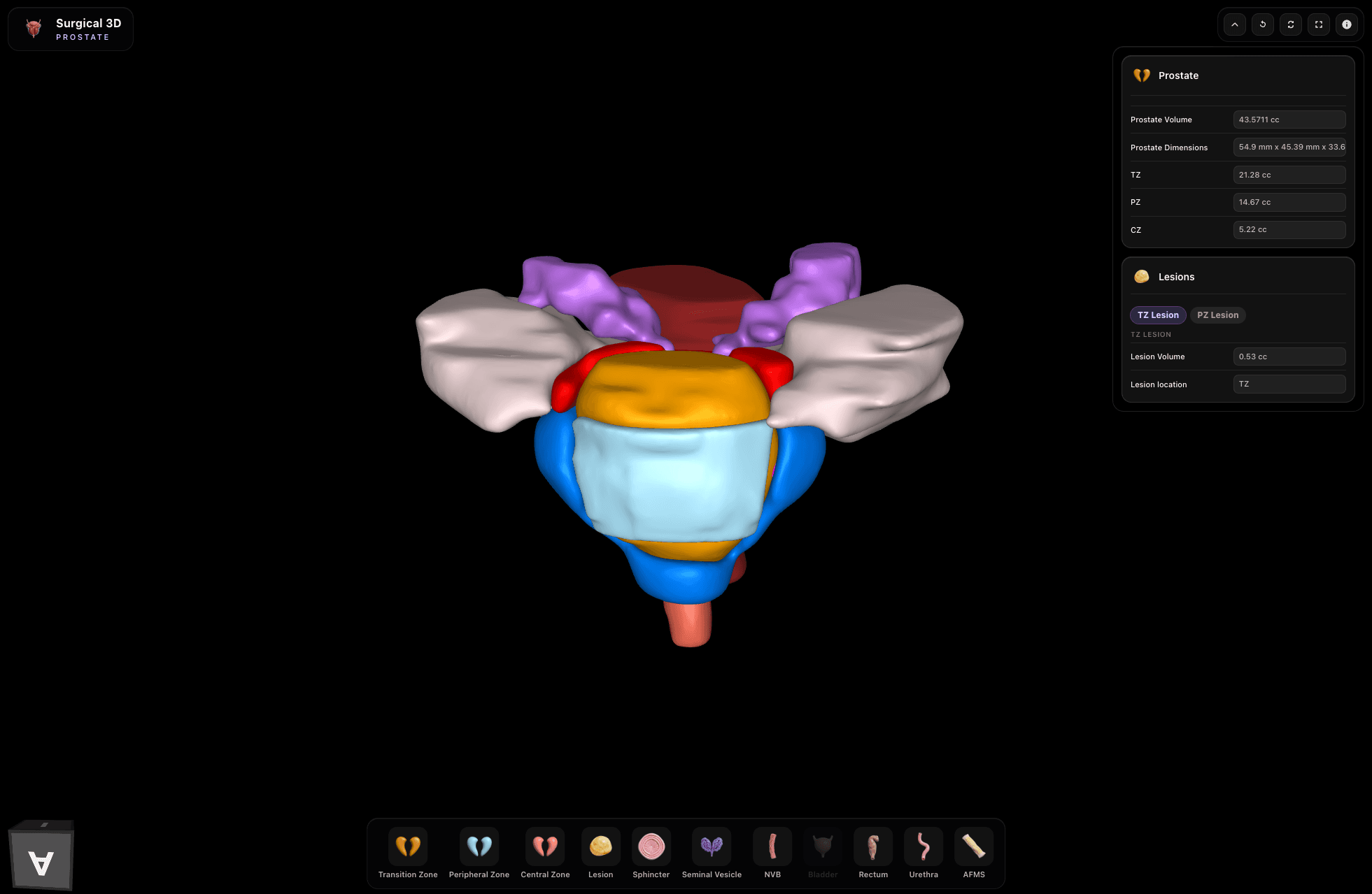 Prostate 3D reconstruction